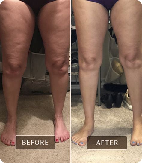 fascia blaster results|Fascia blasting: The real science behind the trend.